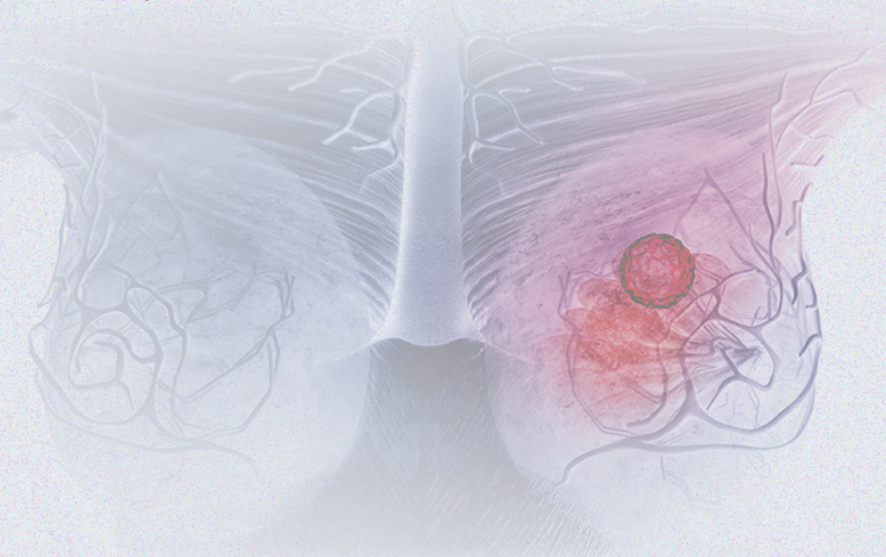 國(guó)際婦女節(jié) | 關(guān)注乳腺癌 微創(chuàng)介入讓美麗繼續(xù)，「乳」愿以償正成為現(xiàn)實(shí)