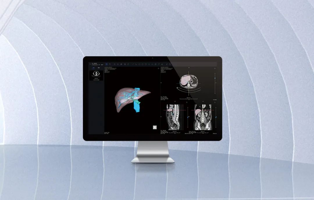 北京市首款！海杰亞醫(yī)療自主研發(fā)的AI+肝臟CT影像處理軟件獲批上市！